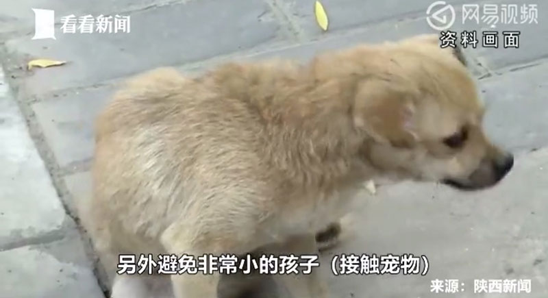 ผงะ.. พบพยาธิยั้วเยี้ยในตาทารก 5 เดือน คีบออกมาได้ 11 ตัว คาดติดจากสัตว์เลี้ยง ผงะ.. พบพยาธิยั้วเยี้ยในตาทารก 5 เดือน คีบออกมาได้ 11 ตัว คาดติดจากสัตว์เลี้ยง