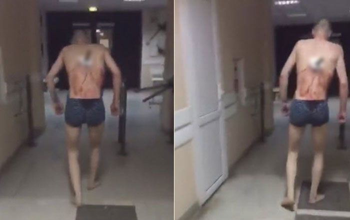 โหดจัดรัสเซีย...หนุ่มโดนมีดปักกลางหลัง แต่ยังย่องจะไปดูดบุหรี่ ชิลจนโดนพยาบาลดุ โหดจัดรัสเซีย...หนุ่มโดนมีดปักกลางหลัง แต่ยังย่องจะไปดูดบุหรี่ ชิลจนโดนพยาบาลดุ