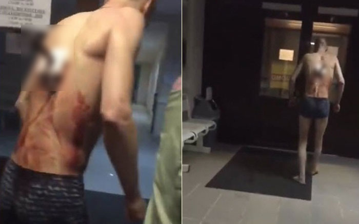 โหดจัดรัสเซีย...หนุ่มโดนมีดปักกลางหลัง แต่ยังย่องจะไปดูดบุหรี่ ชิลจนโดนพยาบาลดุ โหดจัดรัสเซีย...หนุ่มโดนมีดปักกลางหลัง แต่ยังย่องจะไปดูดบุหรี่ ชิลจนโดนพยาบาลดุ