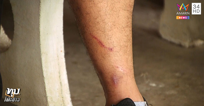 ทหารพราน ถูก อบต. รุมกระทืบ ทหารพราน ถูก อบต. รุมกระทืบ