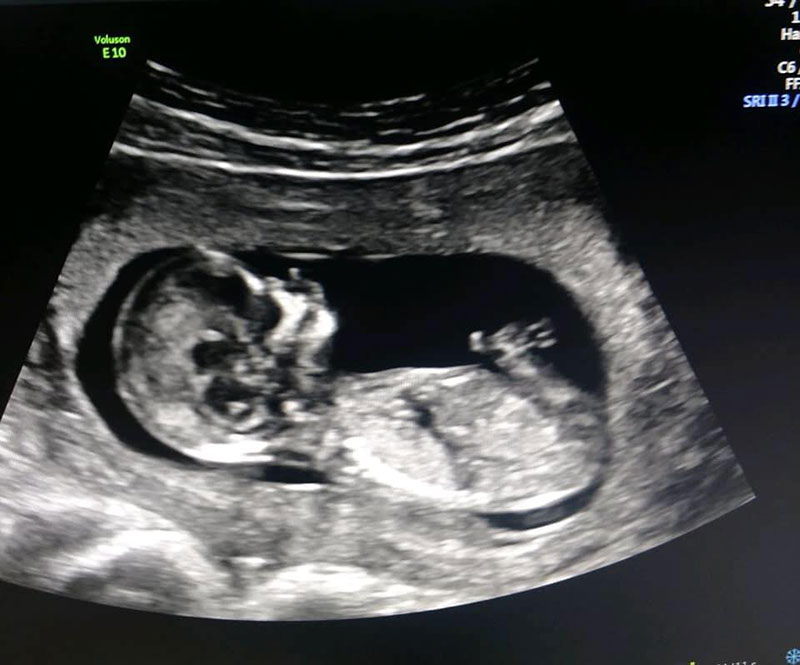 สุดประทับใจ หญิงเป็นแม่อุ้มบุญให้ลูกชายเกย์ คลอดเบบี๋สำเร็จ ในวัย 61 ปี สุดประทับใจ หญิงเป็นแม่อุ้มบุญให้ลูกชายเกย์ คลอดเบบี๋สำเร็จ ในวัย 61 ปี