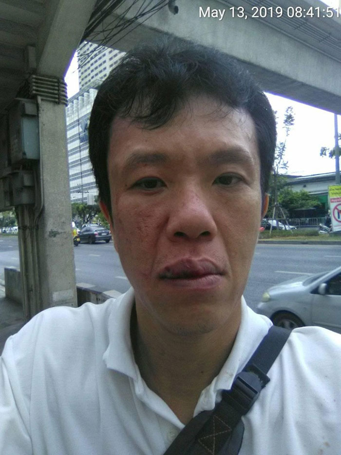 เอกชัย หงส์กังวาน โดนทำร้ายหน้าศาลอาญา เอกชัย หงส์กังวาน โดนทำร้ายหน้าศาลอาญา