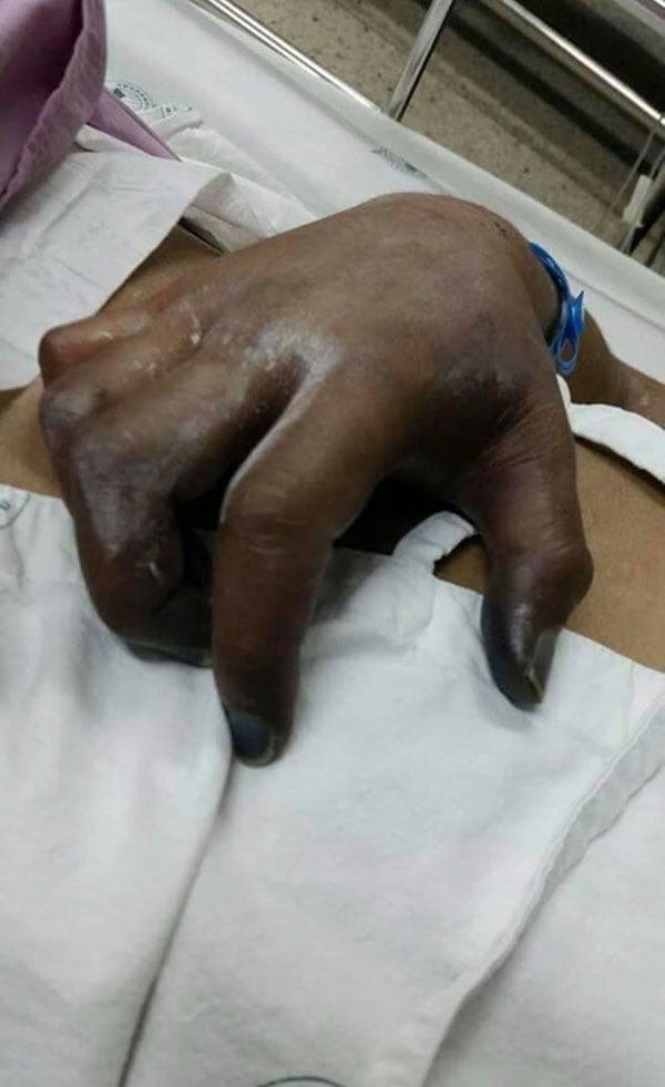 ยาแก้ไมเกรน ยาแก้ไมเกรน