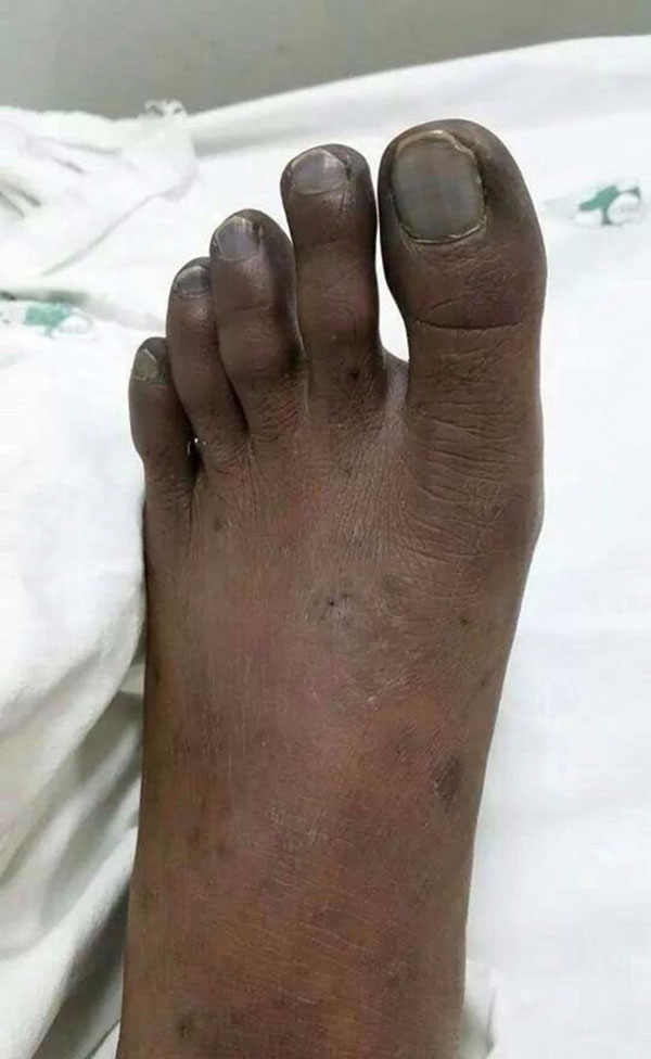 ยาแก้ไมเกรน ยาแก้ไมเกรน