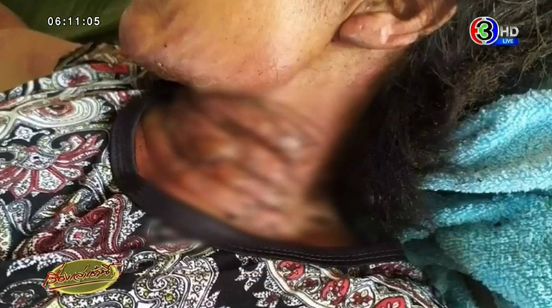 จุดไฟเผาเมีย จุดไฟเผาเมีย