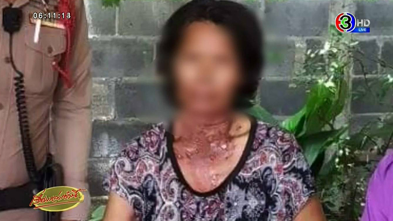 จุดไฟเผาเมีย จุดไฟเผาเมีย