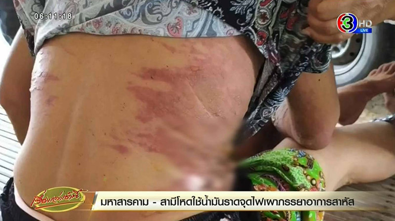 จุดไฟเผาเมีย จุดไฟเผาเมีย