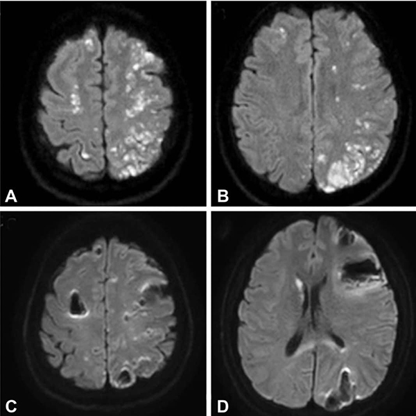 เตือนภัยฉีดฟิลเลอร์ เตือนภัยฉีดฟิลเลอร์
