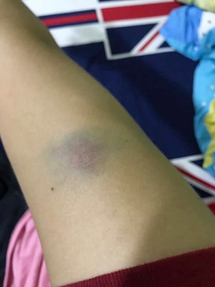 ผัวซ้อมเมีย ผัวซ้อมเมีย