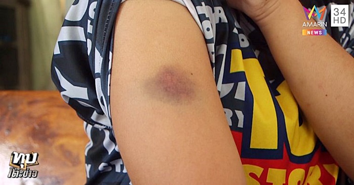 ผัวซ้อมเมีย ผัวซ้อมเมีย