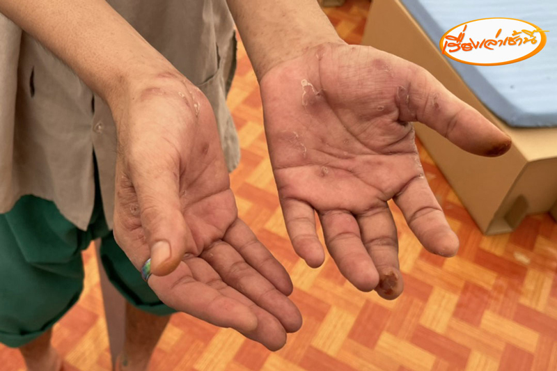 เปิดภาพจุดกักขังผู้บำบัดวัดท่าพุ เปิดภาพจุดกักขังผู้บำบัดวัดท่าพุ