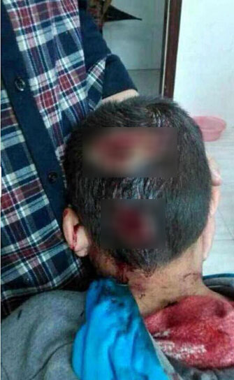 จีนล่าครูโหด ใช้หนังสือตบหัวลูกศิษย์เลือดอาบ-กะโหลกแตก จีนล่าครูโหด ใช้หนังสือตบหัวลูกศิษย์เลือดอาบ-กะโหลกแตก