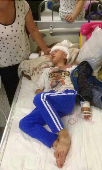 จีนล่าครูโหด ใช้หนังสือตบหัวลูกศิษย์เลือดอาบ-กะโหลกแตก จีนล่าครูโหด ใช้หนังสือตบหัวลูกศิษย์เลือดอาบ-กะโหลกแตก