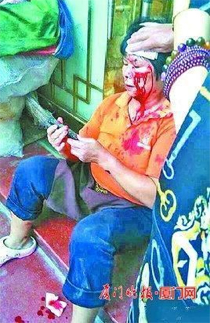 หญิงจีนลัดคิวเข้าห้องน้ำ โดนอิฐฟาดหัวเลือดอาบ หญิงจีนลัดคิวเข้าห้องน้ำ โดนอิฐฟาดหัวเลือดอาบ