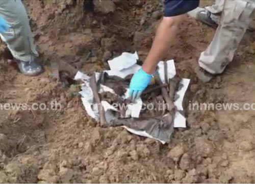 ผลตรวจ 3 โครงกระดูก พบถูกจ่อยิง-ฟันคล้ายของเหยื่อ!