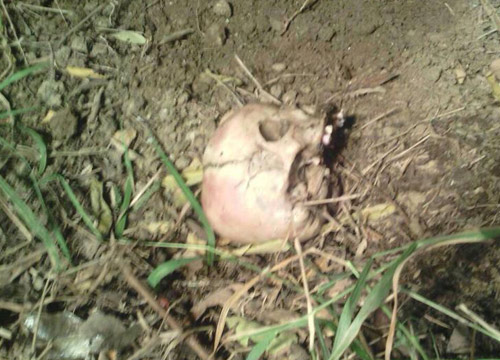 ผล DNA เส้นผม-กะโหลก-เลือด ยืนยันเป็นน้องการ์ตูน ผล DNA เส้นผม-กะโหลก-เลือด ยืนยันเป็นน้องการ์ตูน