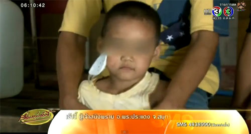 พ่อแม่ร้อง ลูกชาย 5 ขวบ เล่นกับเพื่อน โดนดินสอทิ่มตาบอด พ่อแม่ร้อง ลูกชาย 5 ขวบ เล่นกับเพื่อน โดนดินสอทิ่มตาบอด