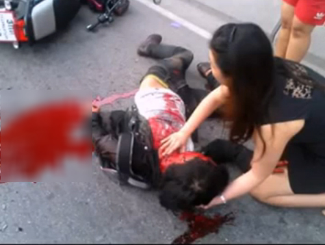 คลิปคุณหมอนางฟ้า ช่วยคนกระจกบาดคอ แม้ตัวเองก็บาดเจ็บ คลิปคุณหมอนางฟ้า ช่วยคนกระจกบาดคอ แม้ตัวเองก็บาดเจ็บ