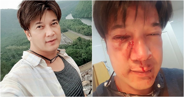 นิค ยูโฟร์ นิค ยูโฟร์