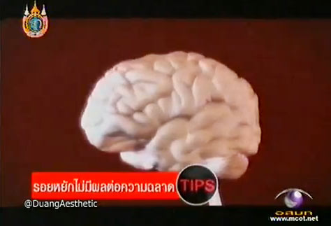 วู้ดดี้เกิดมาคุย : หนูดี วนิษา เรซ ตอบเรื่องสมองในมุมมองสนุก ๆ