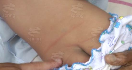 แม่ทำร้ายลูก 7 เดือน ใช้มีดฟันหลัง ทำร้ายร่างกาย แม่ทำร้ายลูก 7 เดือน ใช้มีดฟันหลัง ทำร้ายร่างกาย