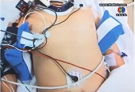 ตีสิบ ย้อนหลัง น้องปลาหมอจมน้ำ แต่รอดตาย ใน รายการตีสิบ ตีสิบ ย้อนหลัง น้องปลาหมอจมน้ำ แต่รอดตาย ใน รายการตีสิบ