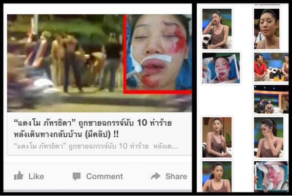 ข่าวแตงโมโดนทำร้าย ที่แท้มือดีปล่อยภาพเก่าตอนรถคว่ำ ข่าวแตงโมโดนทำร้าย ที่แท้มือดีปล่อยภาพเก่าตอนรถคว่ำ