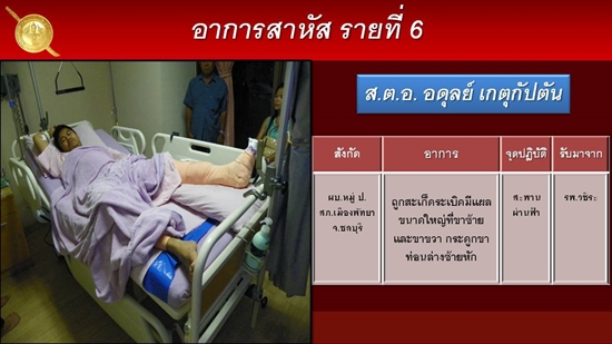 ส.ต.อ.อดุลย์ เกตุกัปตัน ส.ต.อ.อดุลย์ เกตุกัปตัน