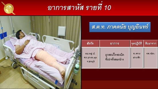ส.ต.ท.ภาคดนัย บุญอินทร์ ส.ต.ท.ภาคดนัย บุญอินทร์