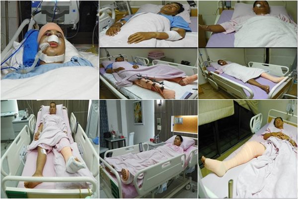 เผยชื่อ 12 ตำรวจ ถูกยิง-โดนสะเก็ดระเบิด เจ็บหนักจากเหตุปะทะผ่านฟ้า เผยชื่อ 12 ตำรวจ ถูกยิง-โดนสะเก็ดระเบิด เจ็บหนักจากเหตุปะทะผ่านฟ้า