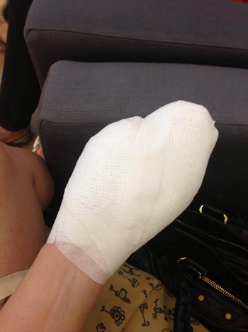 อุทาหรณ์...ผู้ที่ชอบนำไฟเย็นมาถ่ายรูป อุทาหรณ์...ผู้ที่ชอบนำไฟเย็นมาถ่ายรูป