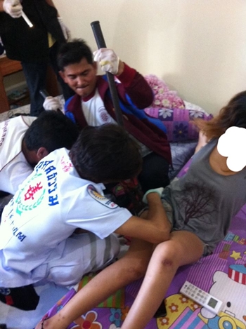 อุทาหรณ์ วัยรุ่นภูเก็ตถูกเหล็กเสียบก้น หลังโดดขึ้นเตียงสปริง อุทาหรณ์ วัยรุ่นภูเก็ตถูกเหล็กเสียบก้น หลังโดดขึ้นเตียงสปริง