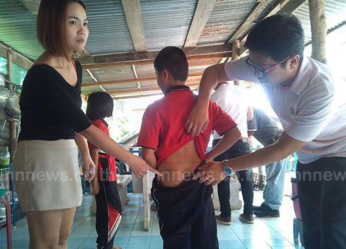 แม่โวย ครูทำโทษลูกเกินกว่าเหตุ ตีก้น 80 ที แม่โวย ครูทำโทษลูกเกินกว่าเหตุ ตีก้น 80 ที