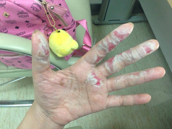 อุทาหรณ์...ผู้ที่ชอบนำไฟเย็นมาถ่ายรูป อุทาหรณ์...ผู้ที่ชอบนำไฟเย็นมาถ่ายรูป