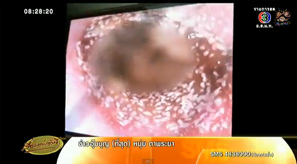 สัตว์ประหลาดคล้ายผงแป้งเดินยั้วเยี้ยเต็มรูหู สัตว์ประหลาดคล้ายผงแป้งเดินยั้วเยี้ยเต็มรูหู