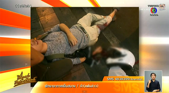 เปิดคลิปหนุ่มสู้สุดตัว พิทักษ์ไอโฟน 6 โดนคนร้ายรัวฟันแขนกลางเมือง เปิดคลิปหนุ่มสู้สุดตัว พิทักษ์ไอโฟน 6 โดนคนร้ายรัวฟันแขนกลางเมือง