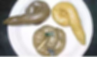 ญี่ปุ่นเปิบเมนูพิสดาร อุนจิสาวพรหมจรรย์ ยาอายุวัฒนะ ญี่ปุ่นเปิบเมนูพิสดาร อุนจิสาวพรหมจรรย์ ยาอายุวัฒนะ