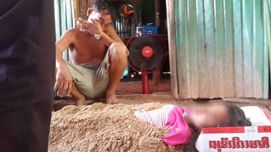 เด็กหญิงถูกไฟช็อตดับ เด็กหญิงถูกไฟช็อตดับ