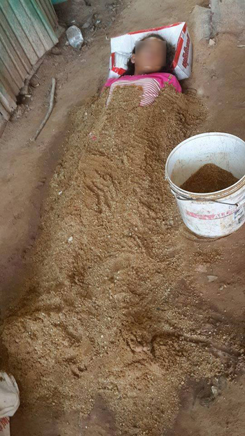 เด็กหญิงถูกไฟช็อตดับ เด็กหญิงถูกไฟช็อตดับ