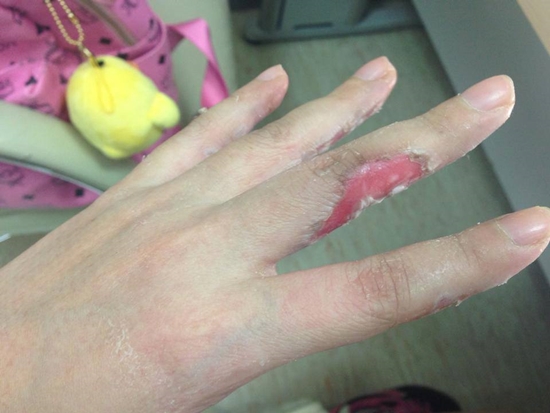 อุทาหรณ์...ผู้ที่ชอบนำไฟเย็นมาถ่ายรูป อุทาหรณ์...ผู้ที่ชอบนำไฟเย็นมาถ่ายรูป