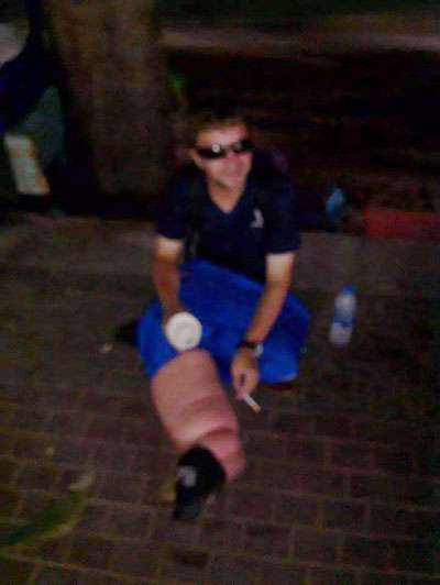 ข่าวฝรั่งขาบวมขอทาน ข่าวฝรั่งขาบวมขอทาน