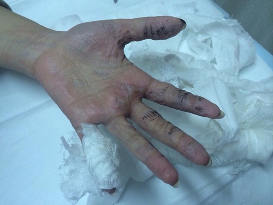 อุทาหรณ์...ผู้ที่ชอบนำไฟเย็นมาถ่ายรูป อุทาหรณ์...ผู้ที่ชอบนำไฟเย็นมาถ่ายรูป