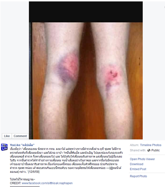 ร้องโซเชียลเพื่อนโดนตำรวจซ้อม ร้องโซเชียลเพื่อนโดนตำรวจซ้อม