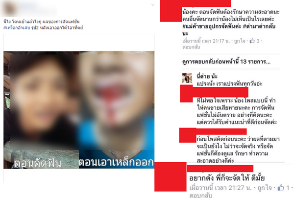 ดัดฟันแฟชั่น ดัดฟันแฟชั่น