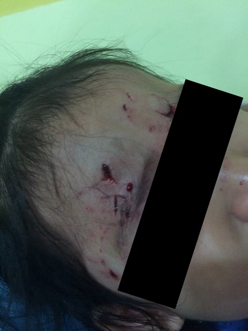 ลูกค้าโวย หลานสาวถูกหมาหน้าเซเว่นฯ กัดเป็นแผลเหวอะ ถามใครจะรับผิดชอบ ? ลูกค้าโวย หลานสาวถูกหมาหน้าเซเว่นฯ กัดเป็นแผลเหวอะ ถามใครจะรับผิดชอบ ?