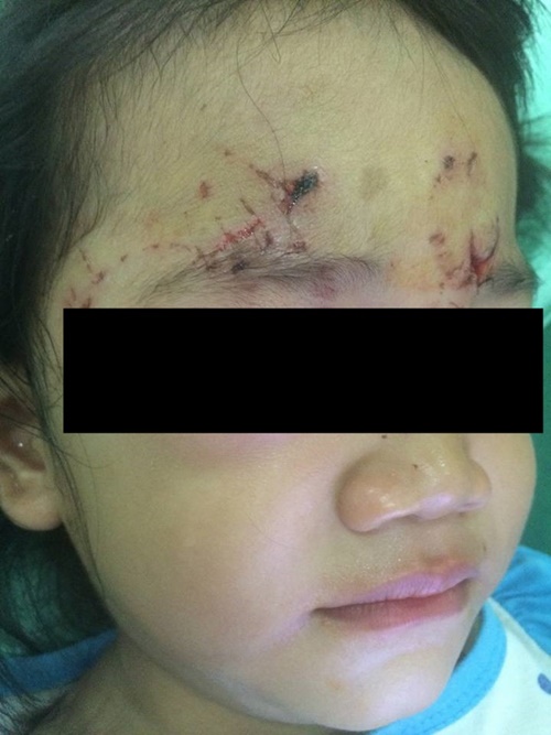 ลูกค้าโวย หลานสาวถูกหมาหน้าเซเว่นฯ กัดเป็นแผลเหวอะ ถามใครจะรับผิดชอบ ? ลูกค้าโวย หลานสาวถูกหมาหน้าเซเว่นฯ กัดเป็นแผลเหวอะ ถามใครจะรับผิดชอบ ?