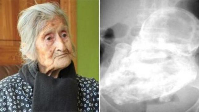 คุณยายวัย 91 อึ้ง พบตัวเอง คุณยายวัย 91 อึ้ง พบตัวเอง