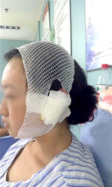 เจ้าของสุนัขยัวะ กัดหูสาวจนขาด ฉุนมาเตะพุดเดิ้ลสุดรักของตัวเอง เจ้าของสุนัขยัวะ กัดหูสาวจนขาด ฉุนมาเตะพุดเดิ้ลสุดรักของตัวเอง