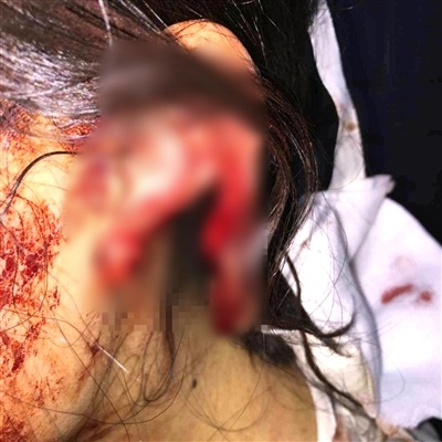 เจ้าของสุนัขยัวะ กัดหูสาวจนขาด ฉุนมาเตะพุดเดิ้ลสุดรักของตัวเอง เจ้าของสุนัขยัวะ กัดหูสาวจนขาด ฉุนมาเตะพุดเดิ้ลสุดรักของตัวเอง