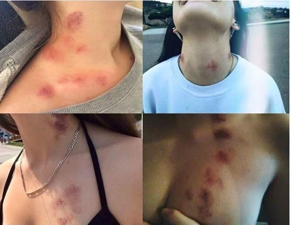 กระทงทำพิษ กระทงทำพิษ